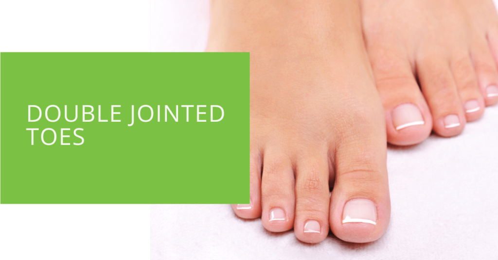 Double Jointed Toes