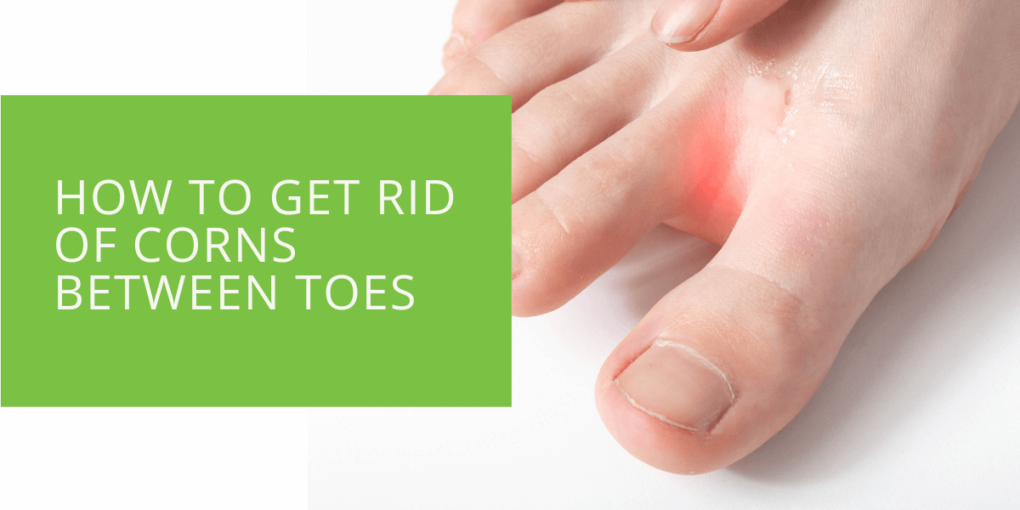 How to Get Rid of Corns Between Toes