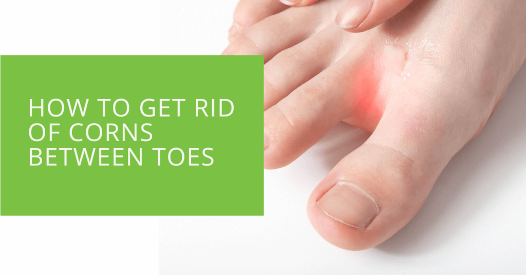 How to Get Rid of Corns Between Toes