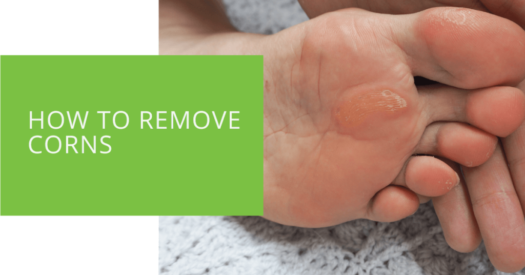 How to Remove Corns