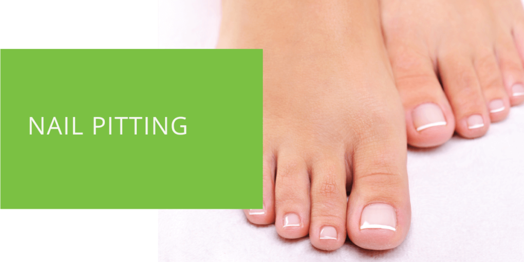 Proposing an Algorithm to Treat Dystrophic Toenails | Podiatry Today