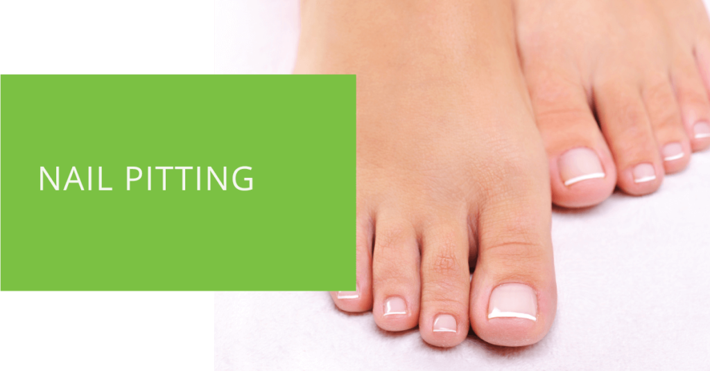 Nail Pitting