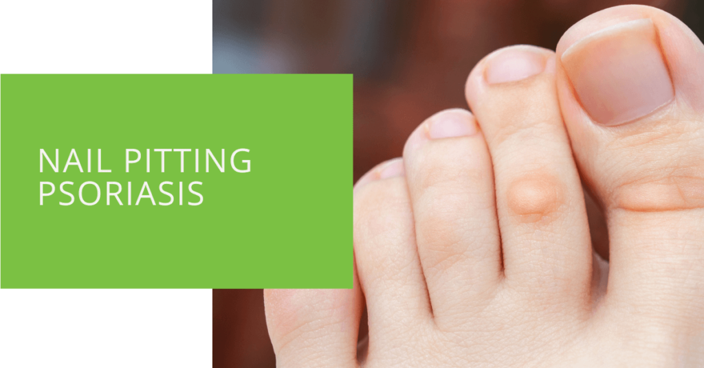 Nail Pitting Psoriasis