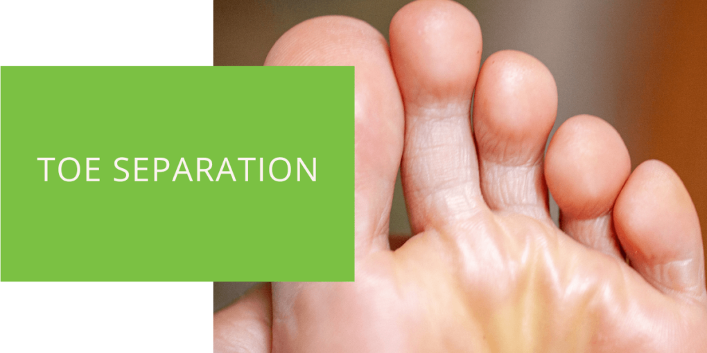 Toe Separation