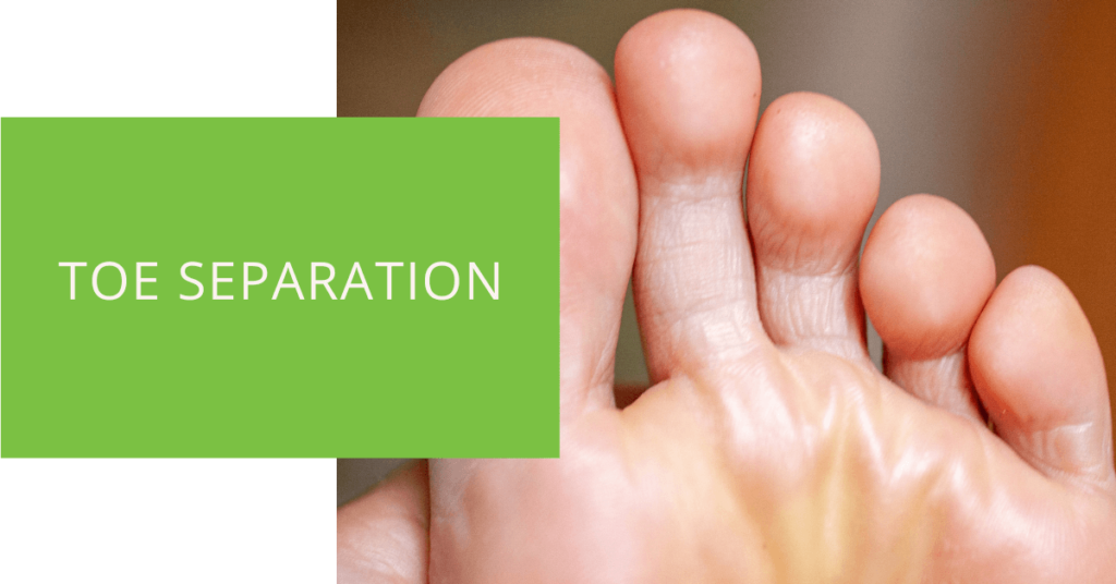Toe Separation