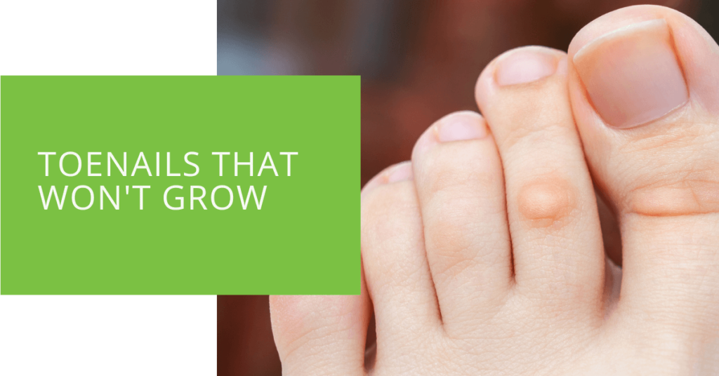 Toenails That Won't Grow