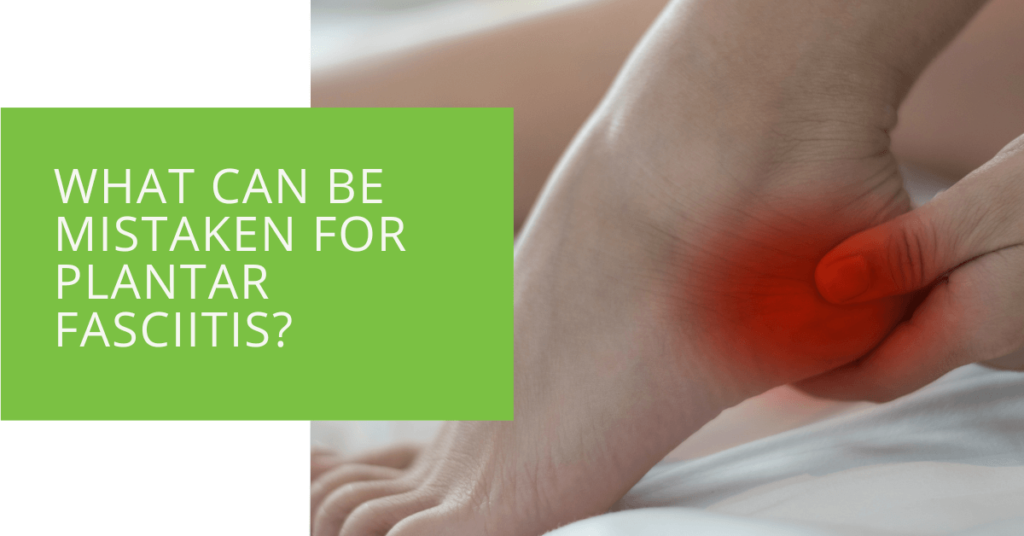 What Can Be Mistaken for Plantar Fasciitis