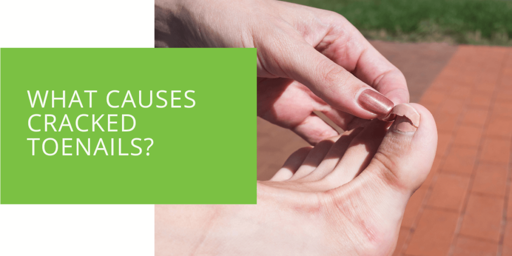 What Causes Cracked Toenails