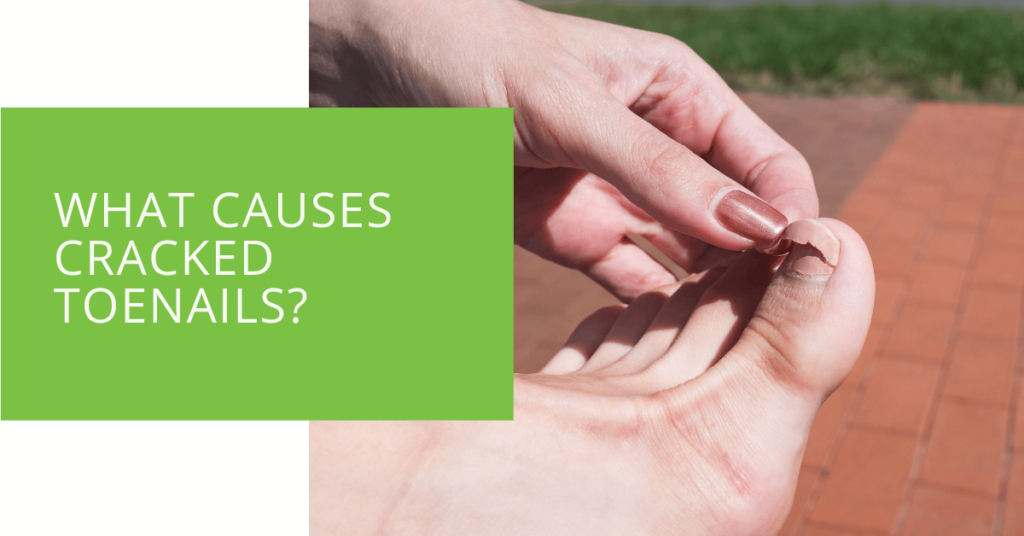 What Causes Cracked Toenails